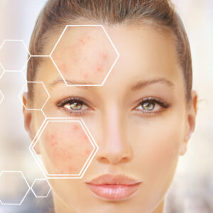 Dermatologie
